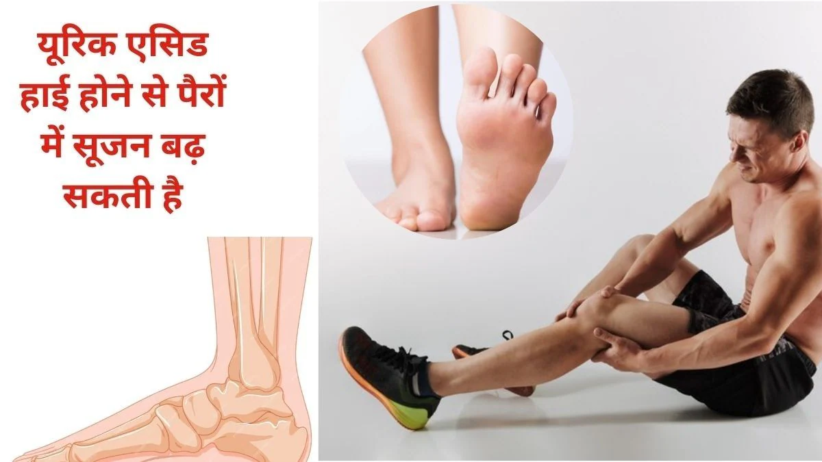Home Remedies For Gout: यूरिक एसिड बढ़ गया, पैर के अंगूठे में सूजन के साथ निकल रही है आग भी, इस आयुर्वेदिक ड्रिंक से हो जाएगा बिना दवा के उपचार