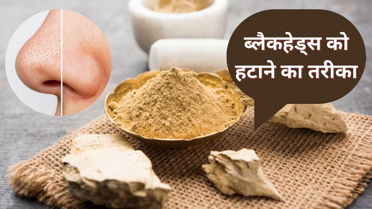 ब्लैकहेड्स को हटाने के लिए इस तरह लगाएं मुल्तानी मिट्टी, स्किन नजर आएगी फ्रेश