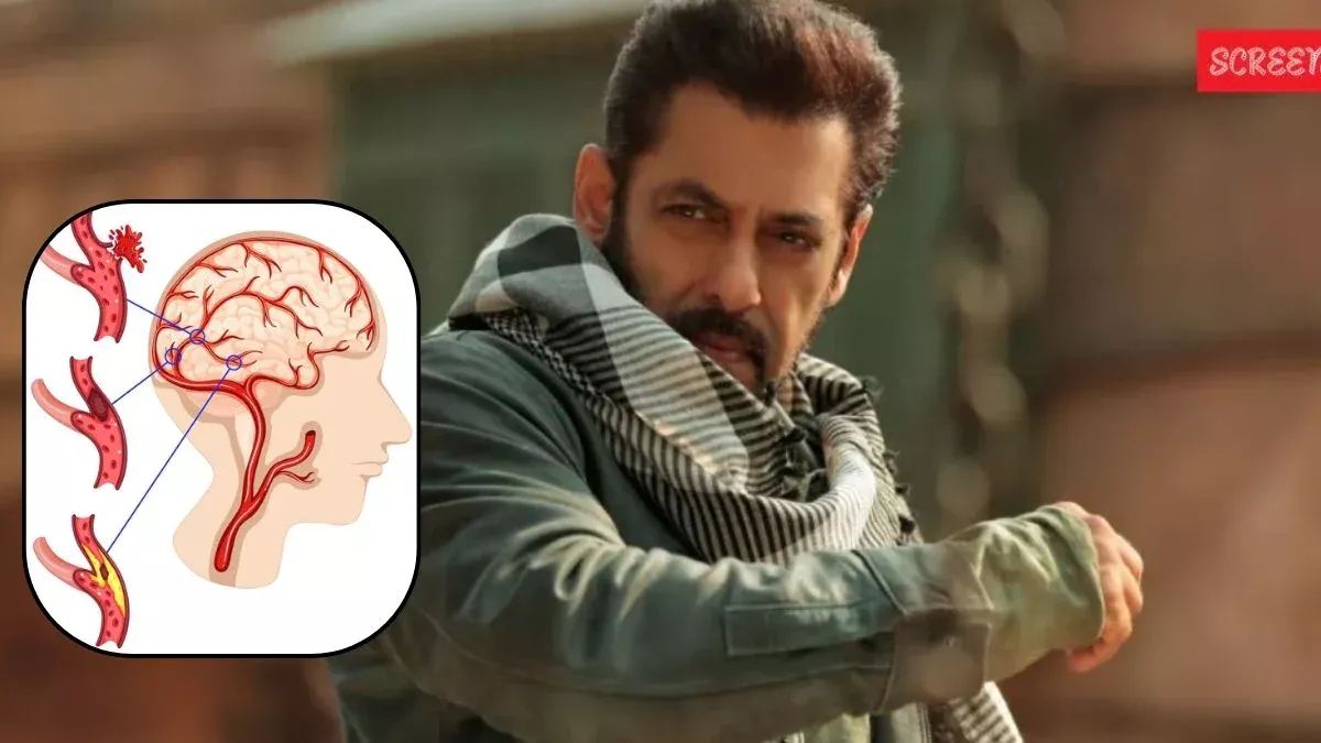 दिमाग के साथ नसों की इन गंभीर बीमारियों से पीड़ित हैं सलमान खान, एक्सपर्ट से जानिए क्या है Brain Aneurysm, इसके लक्षण और बचाव