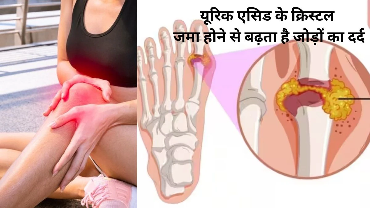 ये 5 लक्षण बताते हैं कि बॉडी में बढ़ रहा है Uric Acid का स्तर, इन 3 सिंपल तरीकों से करें तुरंत कंट्रोल, जोड़ों का दर्द और सूजन हो जाएगी कम